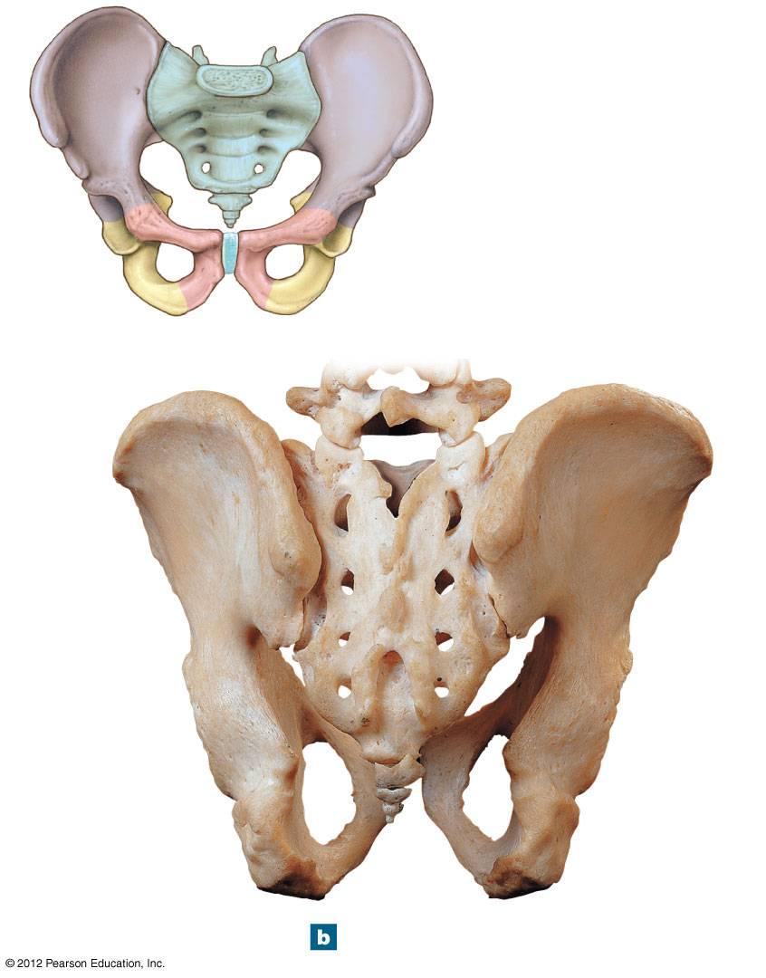 Figure 8-8b The Pelvis of an Adult Male SACRUM COCCYX ILIUM PUBIS Hip bone (Figure 8 7) ISCHIUM Iliac crest L5 Sacral foramina