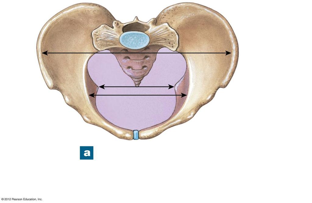 Figure 8-9a Divisions of the Pelvis False pelvis Pelvic outlet Pelvic brim