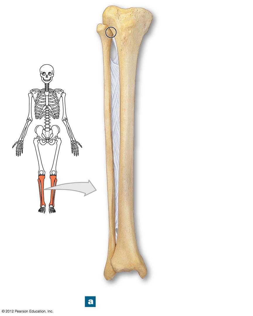 Figure 8-13a The Right Tibia and Fibula Lateral tibial condyle Medial tibial condyle Head of fibula Superior tibiofibular joint Tibial