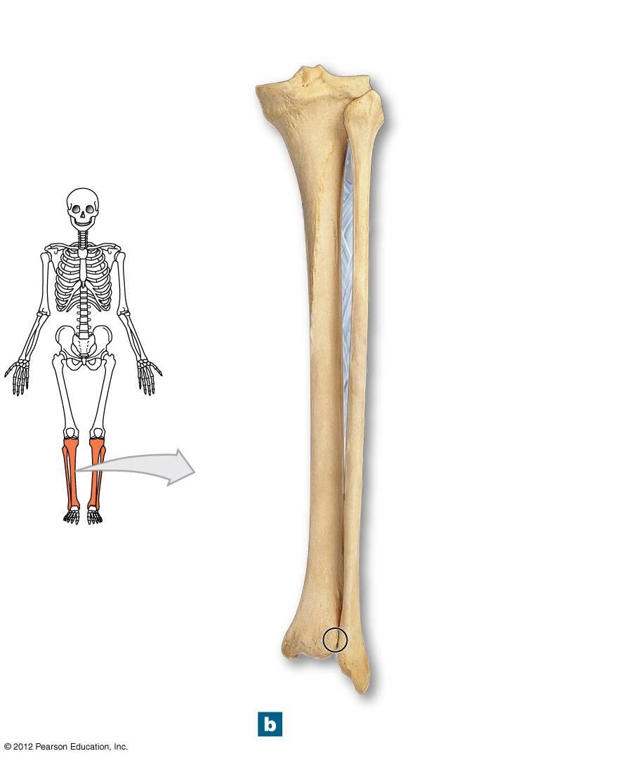 Figure 8-13b The Right Tibia and Fibula Articular surface of medial tibial condyle Medial tibial condyle Intercondylar eminence Articular surface of lateral tibial condyle
