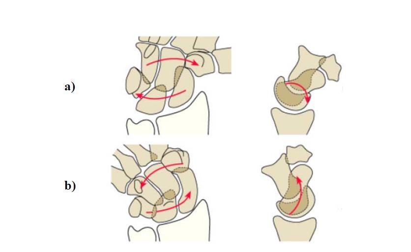 Figure 2-10 Radial and ulnar deviations are depicted schematically showing combined motion of carpal bones in coronal and sagittal plane [73].