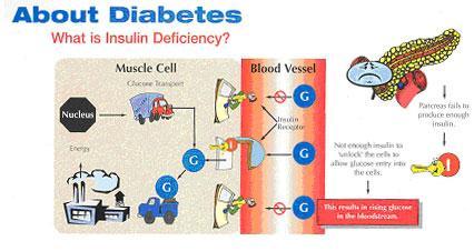 Type 1 diabetes Type 1 diabetes (previously known as insulin-dependent, juvenile or childhood-onset) is