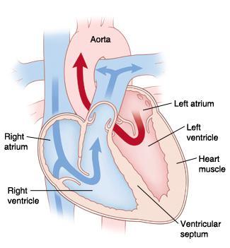 Cardiac