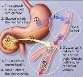 diabetes mellitus which refers to the presence of sugar in the