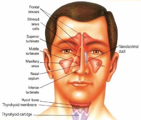Sinusitis - continued Treatment is directed at support care o Nasal