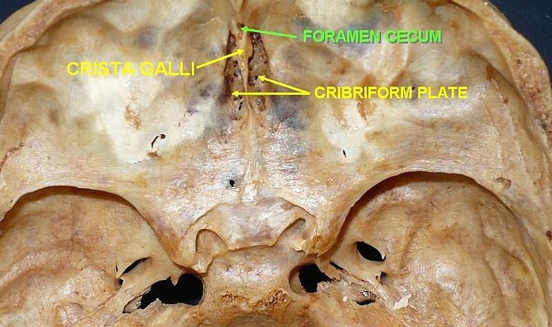 bony extension of the frontal bone Foramen