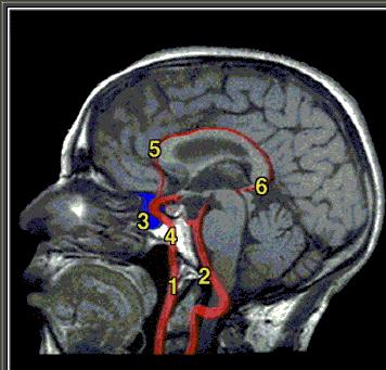 Vertebral artery 3. Cavernous sinus 4.
