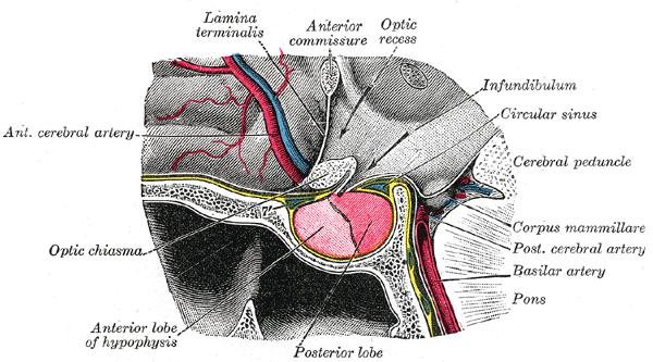 body of the sphenoid