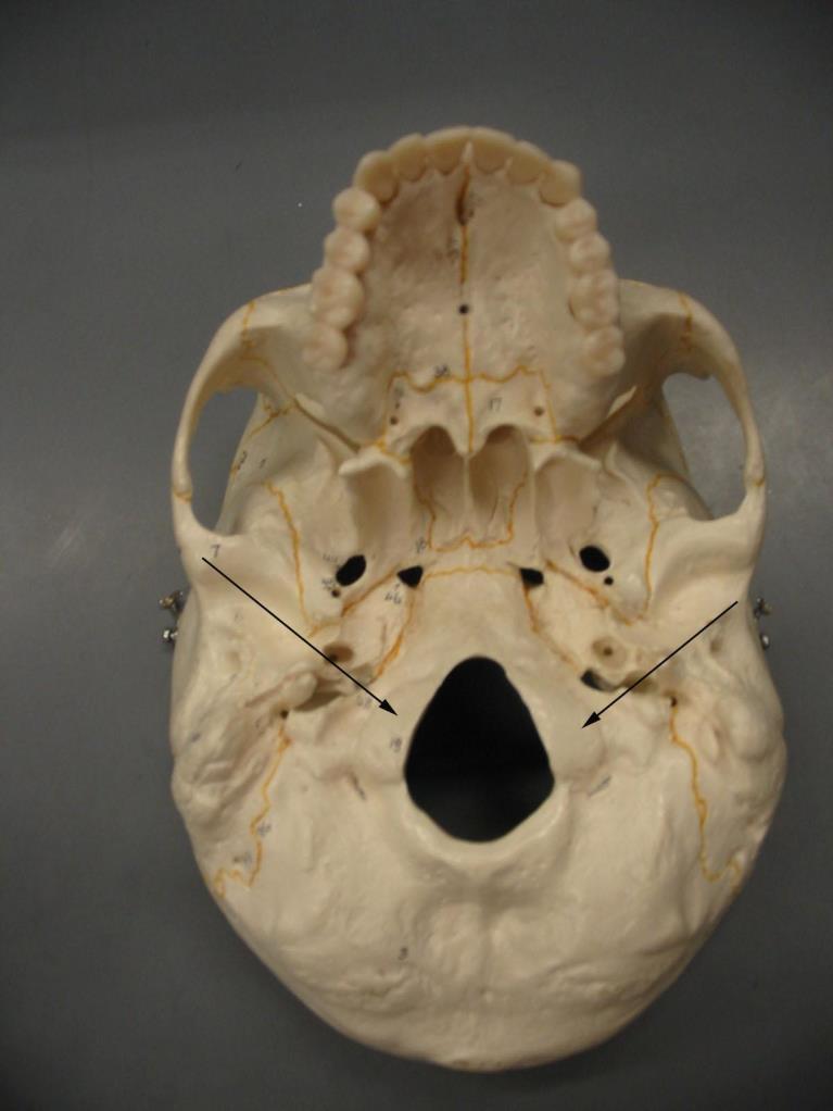 occipital condyles Two large