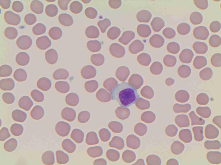 Mature Red Blood Cell 7-8 microns; round / ovoid biconcave disc with orange-red cytoplasm, no RNA,