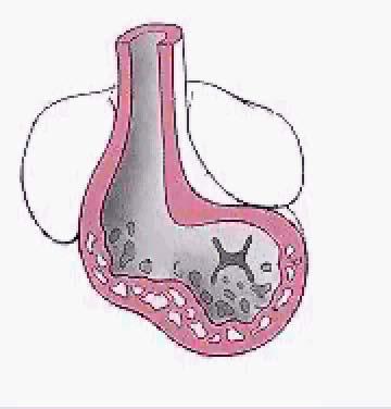 Embryology of the A-V