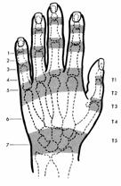 extension of IPs DAB PAD Extensor Tendon Zones: Digits Zone 1: DIP joint Zone 2: Middle phalanx Zone 3: PIP joint Zone 4: Proximal phalanx Zone 5: MPs Zone 6: The dorsal hand, distal to the
