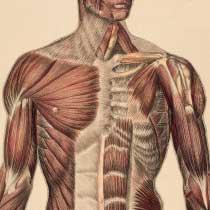 FIGURE 2 Muscles of the chest wall platysma muscle sternocleidomastoid muscle subclavius pectoralis major pectoralis minor intercostal muscle serratus anterior deltoid muscle edema in the absence of