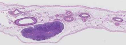 Colon anatomy: embryology, lymphatic drainage, mesocolon Microscopic anatomy Mesentery