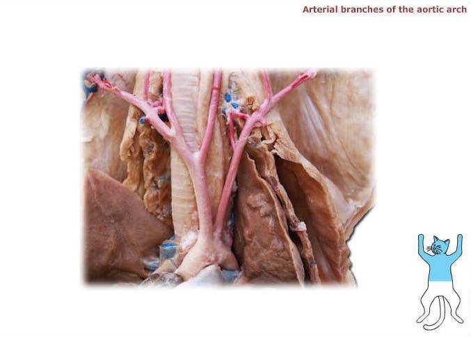 Right common carotid artery Right subclavian artery Left common