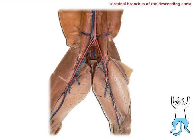 Descending aorta Right internal iliac artery Right external iliac artery Left internal iliac