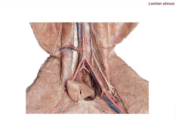Inferior vena cava Abdominal aorta Internal iliac