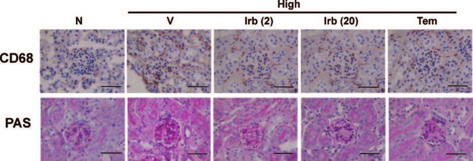 (B) Renal renin mrna levels in individual mice were normalized to GAPDH mrna levels.