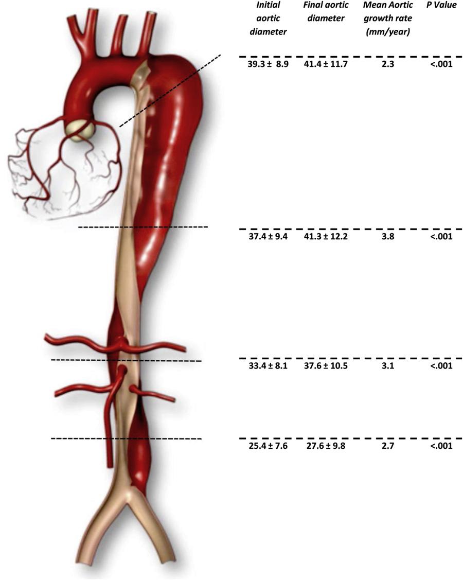 FIGURE 1. Aortic measurements and growth rates at the 4 levels. hospital will die within 3 years.
