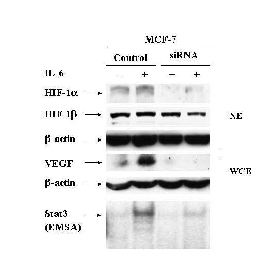 FIGURE 8. Silencing Stat3 blocks IL-6 induction of HIF-1α. MCF-7 cells were stably-transfected with empty psilencer/pcdna3 or psilencer/pcdna3 with Stat3 sirna.