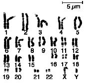 Chromosome Nucleus consists one or more molecules DNA organized into