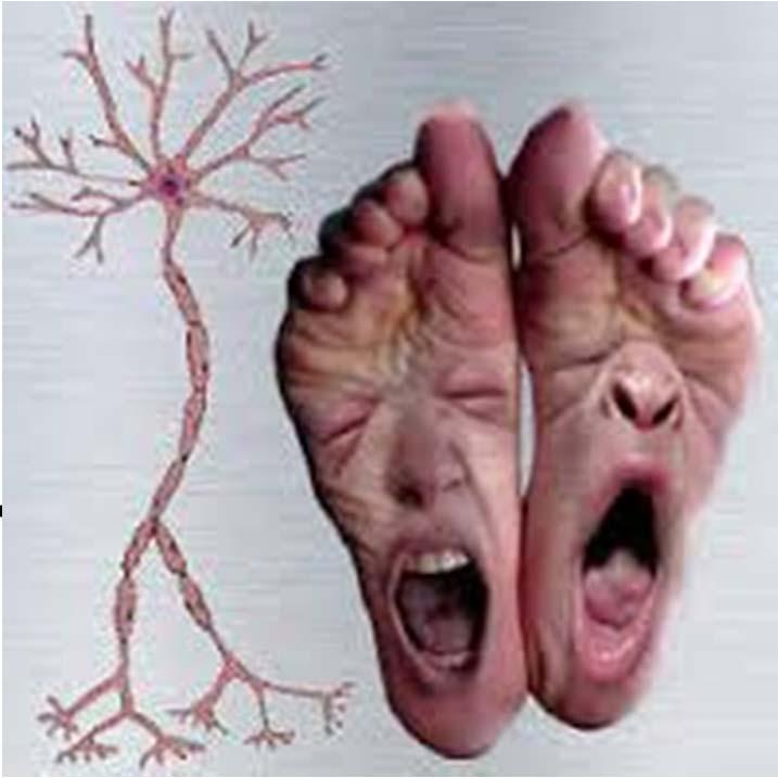 Neuropathy (nerve damage) Nerve disorder Damage can be throughout the body. Some have no symptoms.