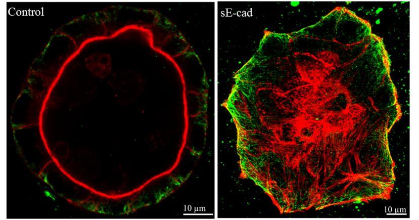 3.3.6 se-cad increases β1 integrin levels The increased fibronectin fibrillar network seen in lumen filled cysts with long- term se-cad treatment is dependent on integrin activity [199].