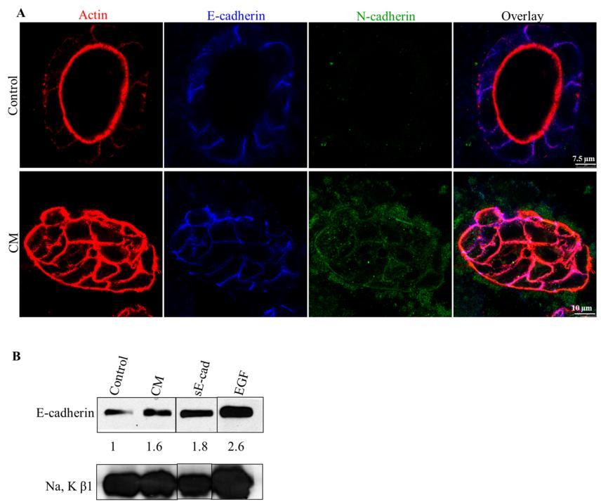 Figure 3.8: 3.4 No change in epithelial protein in lumen filled cysts. (A) Representative merged confocal images showing Actin (Red), Ecadherin (Blue) and N-cadherin (Green).