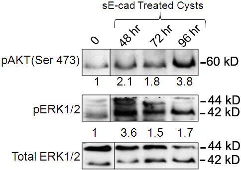 Figure 4.12: Immunoblot showing pakt, perk1/2 and total ERK1/2 in se-cad treated cysts at 48, 72 and 96 h. LY294002 also blocked EMT in CM treated cysts as observed previously in secad treated cysts.