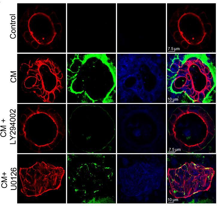Figure 4.13 A: AKT is involved in the induction EMT in CM treated MDCK cysts. Immunofluorescence showing EMT expression in cysts treated CM in presence of inhibitors at 96 h.