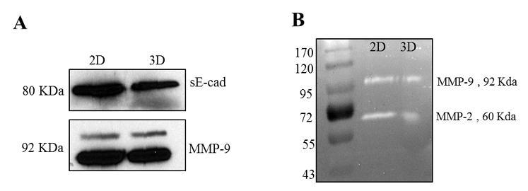 Figure 2.10: High E-cadherin expression in SUM149 cells.