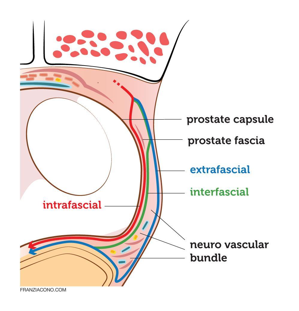 Functional & topographic anatomy of the prostate: what has changed?