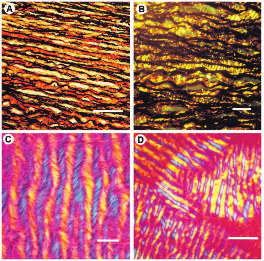 992 J. M. GOSLINE AND R. E. SHADWICK tendon. Tendons are tensile, rope-like structures constructed from bundles of parallel collagen fibres, but the fibres are crimped rather than perfectly straight.