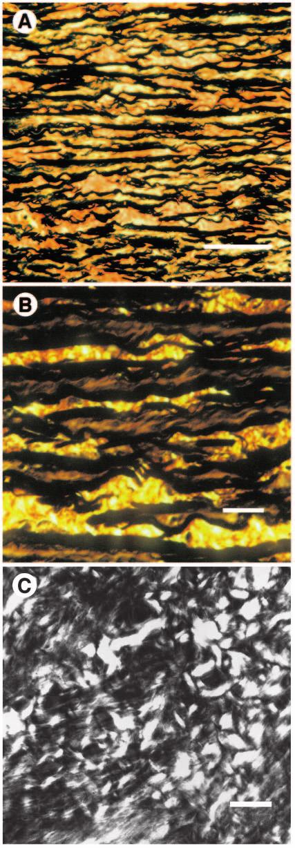 Connective tissue design of whale arteries 993 muscle cells (stained light brown) to form lamellar units.