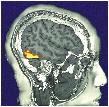 fmri (Functional Magnetic Resonance Imaging) fmri provides dynamic, not just static, information.