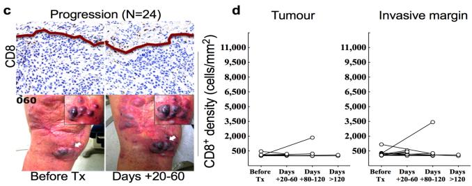Inhibiting PD 1-Mediated Adaptive Immune Resistance Pre-existing T-Cell Infiltration Anti PD-1 Anti PD-L1 Melanoma
