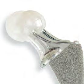 Addressing implant design Many details were considered when designing the ECHELON Primary femoral implants. Clinical performance along with surgical concerns have been addressed in the implant design.