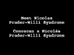 PWS and ASD Several behavioral features of Prader-Willi syndrome including language,