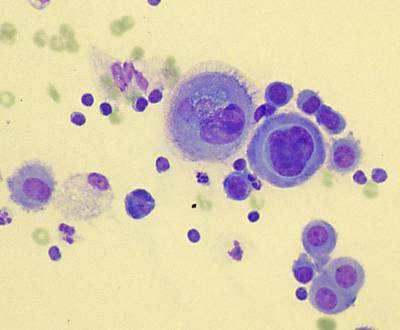mesothelial cells