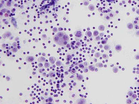 Resemble mesothelial cells isolated round cells