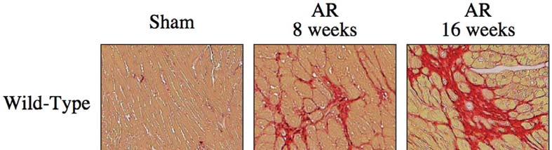 Chronic AR in AT II Type 1a Receptor KO Mice - Survival