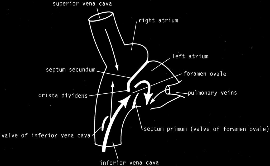 86 Chapter 5 CD Figure 5-7 Relationship between the opening of the inferior vena cava and the foramen ovale.