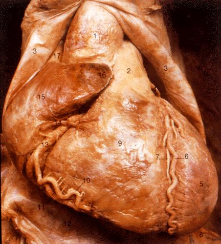 Heart Arterial