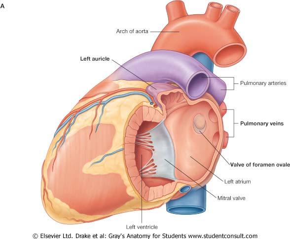 Ventricle Left