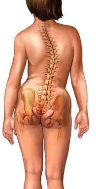 Posture & Muscle Imbalance Scoliosis is a lateral curve of the spine.