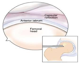 Function of Labrum Deepens