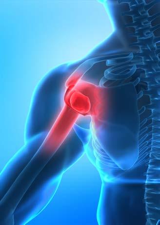 Rehabilitation Guidelines for Shoulder Arthroscopy The true shoulder joint is called the glenohumeral joint and consists humeral head and the glenoid. It is a ball and socket joint.