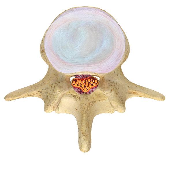 Soft tissue discs are between each of the vertebrae.