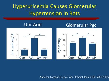 Firstly, Sánchez-Lozada from Florida showed that high uric acid increases glomerular pressure