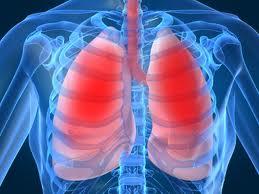 Lungs Pleurisy Chest pain when taking a deep breath Due to